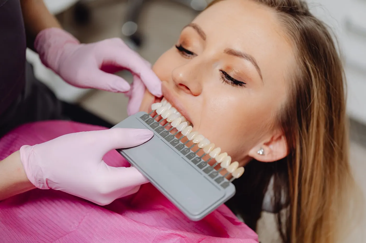 A shade guide held against the teeth to measure colour before whitening